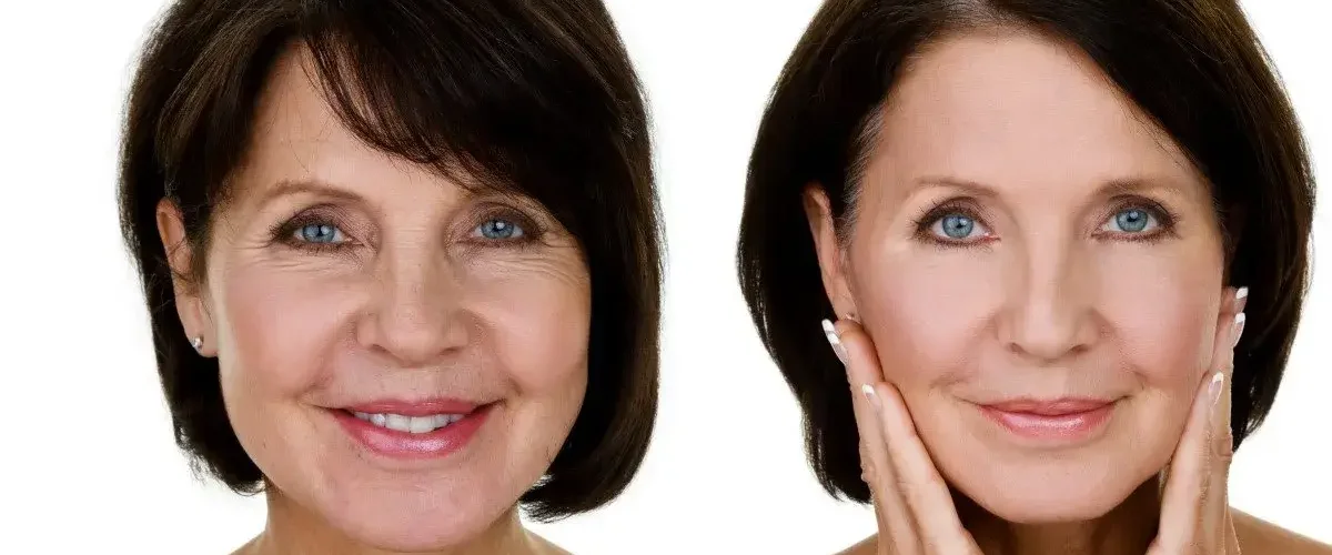 Before-and-after-463622613_5190x3336-1920w